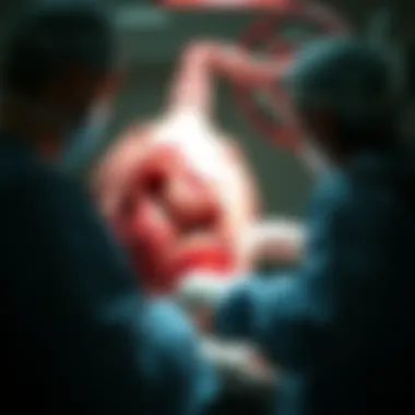 Magnificent Comprehensive Insights into Hiatus Hernia Repair Surgery Magnificent Comprehensive Insights into Hiatus Hernia Repair Surgery