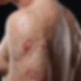 Detailed illustration of psoriasis atopica lesions on skin
