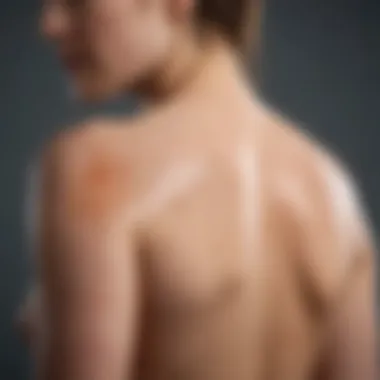 Treatment Options for Psoriasis Atopica Graphical representation of treatment options for psoriasis atopica