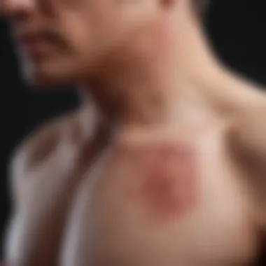 Diagnostic Techniques for Cutaneous Marginal B Cell Lymphoma Diagnostic techniques used for cutaneous marginal B cell lymphoma
