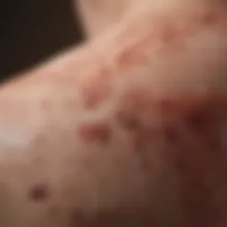 Close-up of psoriasis-affected skin showing characteristic redness and scaling
