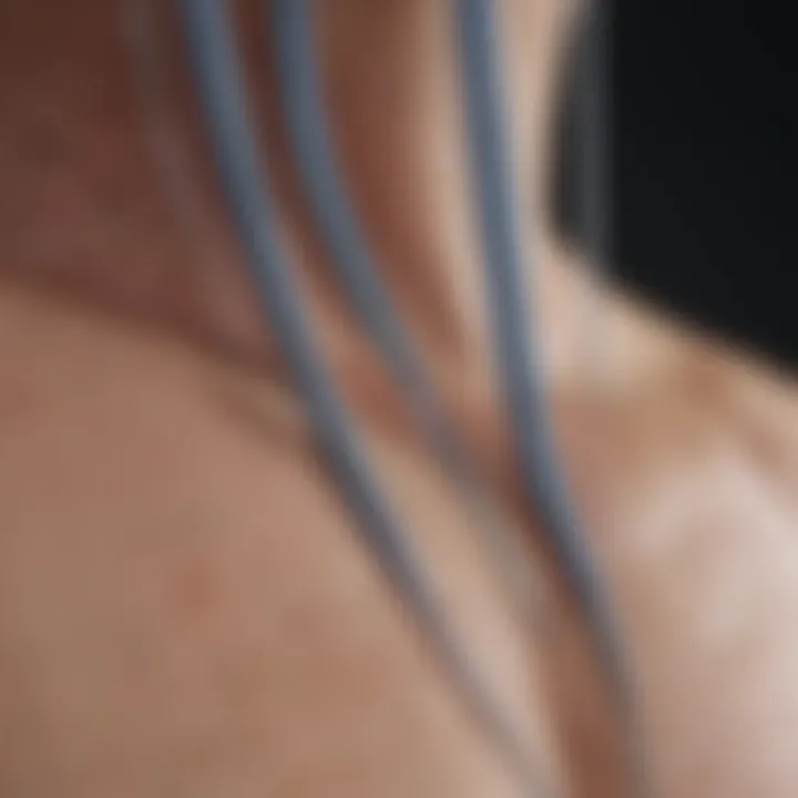 Visual representation of a patient undergoing endovenous ablation