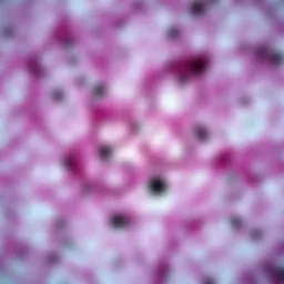 Microscopic view of liver tissue affected by cancer