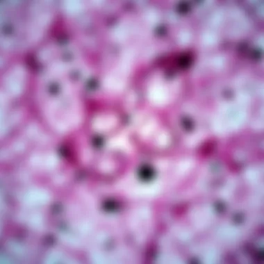 Microscopic Analysis of Liver Cancer Microscopic view of liver tissue affected by cancer