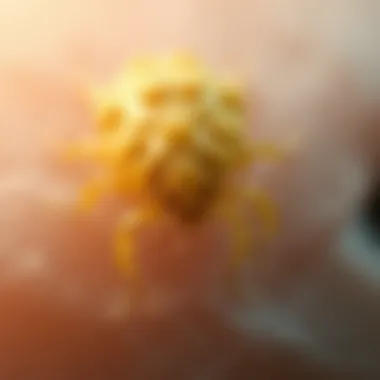 Notable Exploring Demodex Treatment: A Comprehensive Overview
