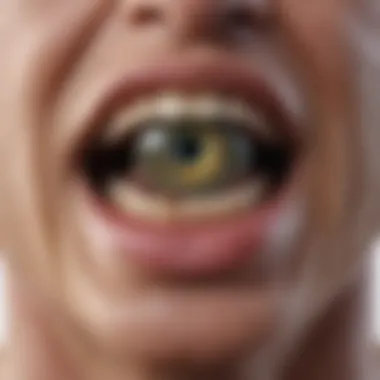 Common Symptoms Associated with Gangrene Tooth Diagram showing common symptoms of gangrene tooth