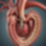 Anatomical illustration of the aortic root highlighting dilation