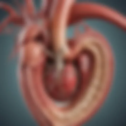 Anatomical illustration of the aortic root highlighting dilation
