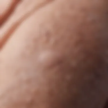 Detailed View of Vesicular Skin Condition Close-up of vesicles on skin