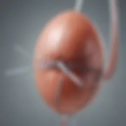 Illustration of HSG balloon catheter anatomy