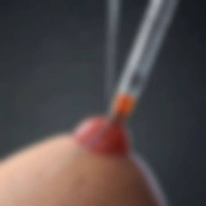 Clinical application scenarios for HSG balloon catheter