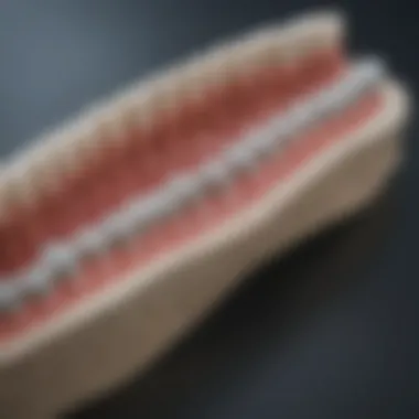 Diagram illustrating the structure of a zirconia bridge