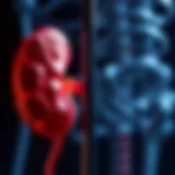 Kidney stones formation process illustrated
