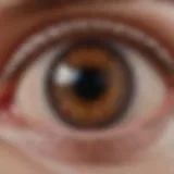 Detailed view of the eyelid anatomy highlighting the meibomian glands
