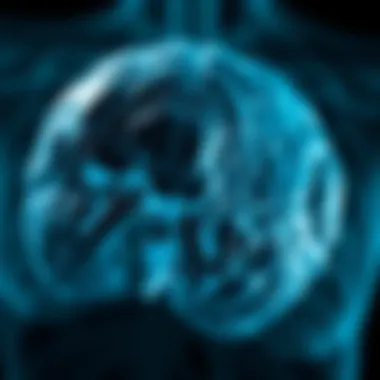 Metastatic Invasive Lobular Carcinoma: An In-Depth Exploration Summary