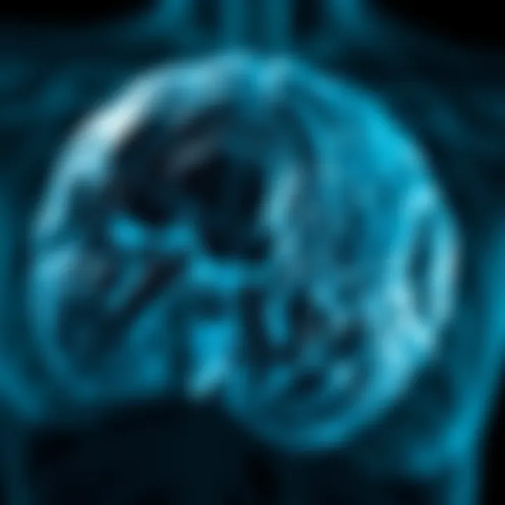 Metastatic Invasive Lobular Carcinoma: An In-Depth Exploration Summary