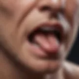 Illustration of nasal polyps within the nasal cavity.