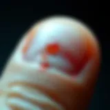 Close-up view of fingernails showing psoriasis symptoms