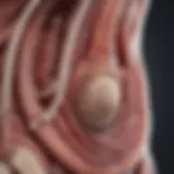 Illustration depicting the anatomy of the terminal ileum