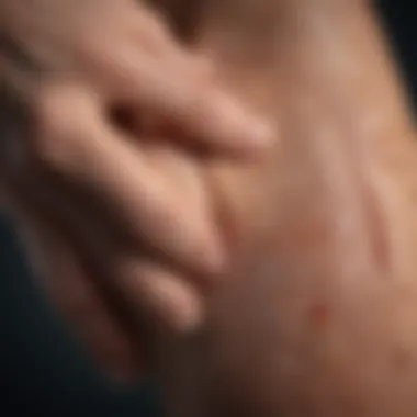 Common Symptoms of Arthritis Chart of Symptoms Associated with Arthritis