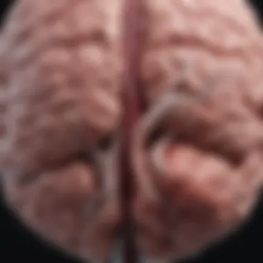Highlighted Areas of Aneurysms in the Brain Illustration of a brain with highlighted aneurysm areas