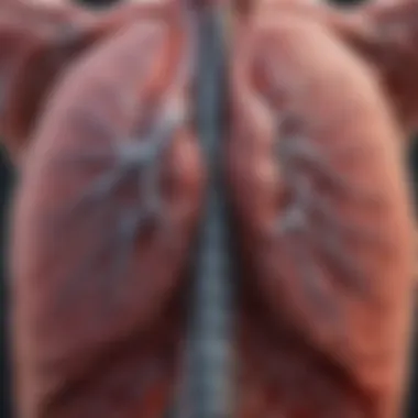 Anatomy of Lungs with Bullae Illustration of lung anatomy highlighting bullae formation