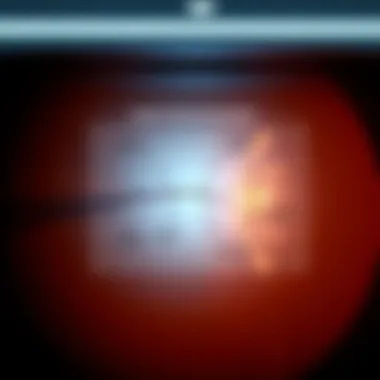Clinical Manifestations of Diabetic Retinal Neuropathy Diagram illustrating clinical manifestations of diabetic retinal neuropathy