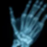 X-ray image showcasing intricate bone structures
