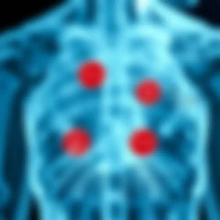 Side Effects Associated with Infliximab Diagram showing potential side effects of infliximab
