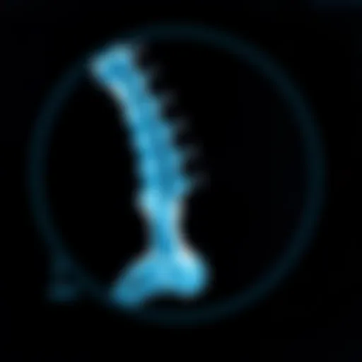 Bone Density Scan Overview Bone density scan illustrating osteoporosis levels