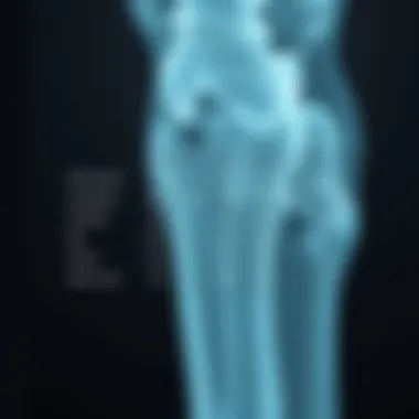 Risk Factors for Osteoporosis Illustration of risk factors associated with osteoporosis