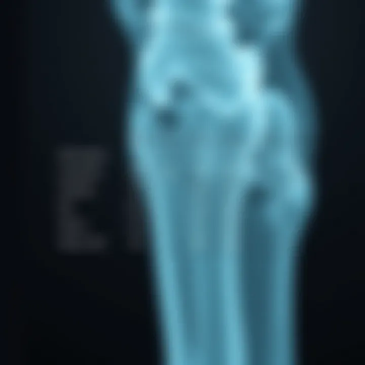 Risk Factors for Osteoporosis Illustration of risk factors associated with osteoporosis