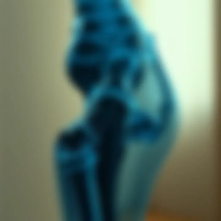 Treatment Options for Osteoporosis Visual representation of treatment options for osteoporosis