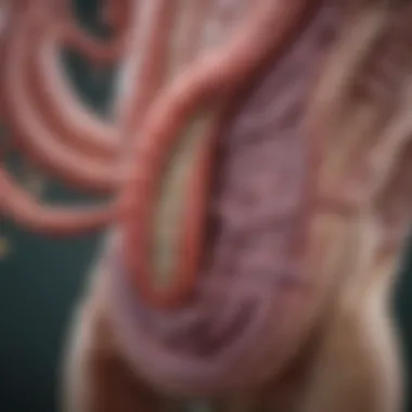 Overview of SIBO Mechanisms Illustration depicting the small intestine with bacterial overgrowth