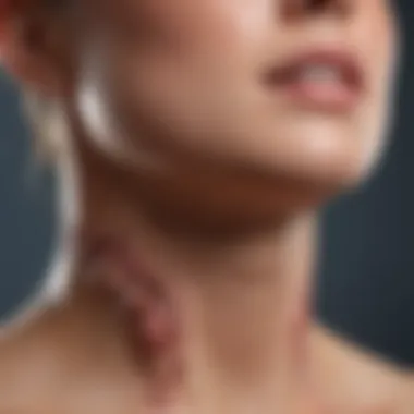 Types of Thyroiditis Visual representation of thyroiditis types